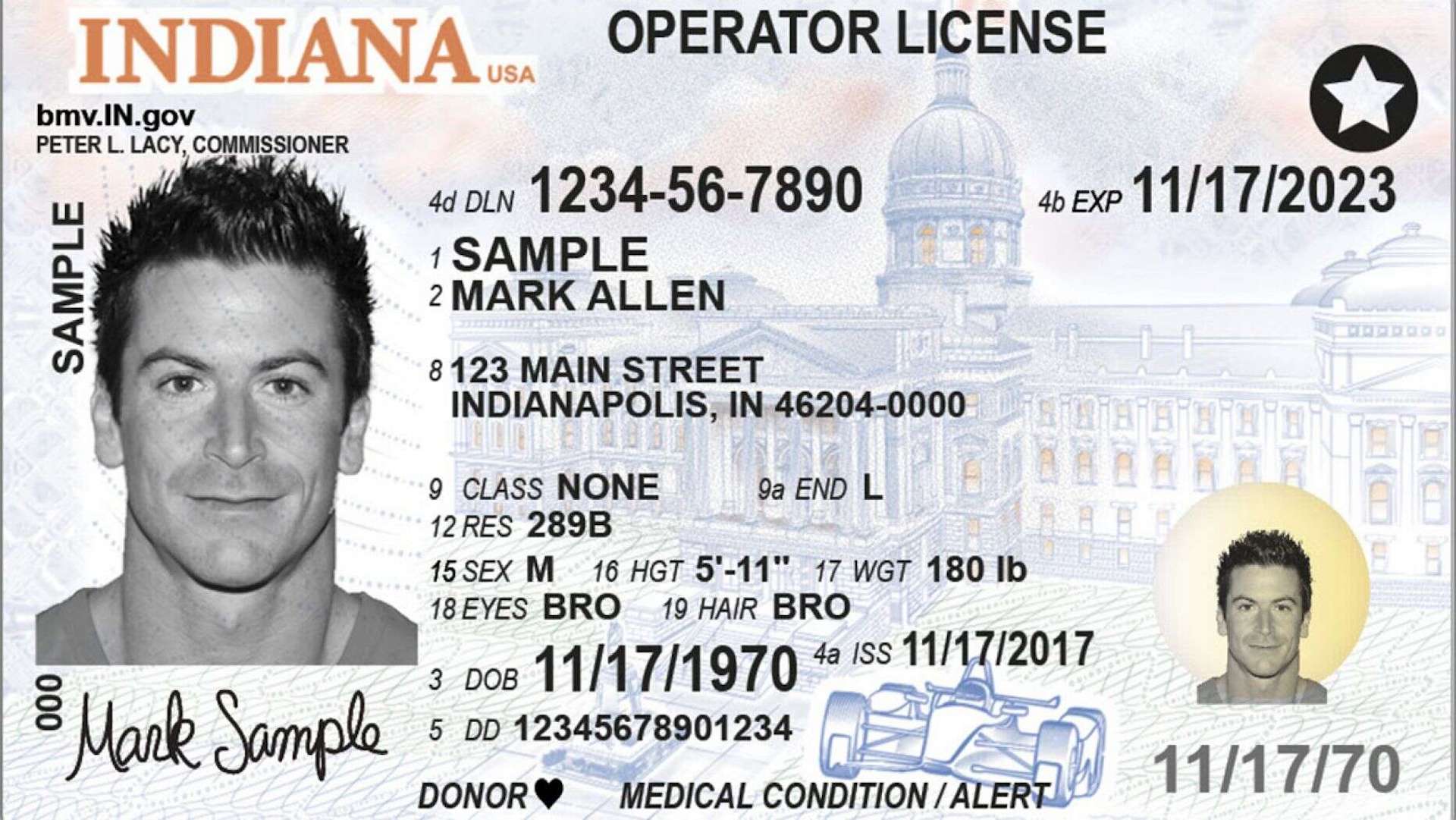 dln meaning on driver's license